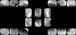 Full mouth dental X-ray series used to detect hidden pet dental disease